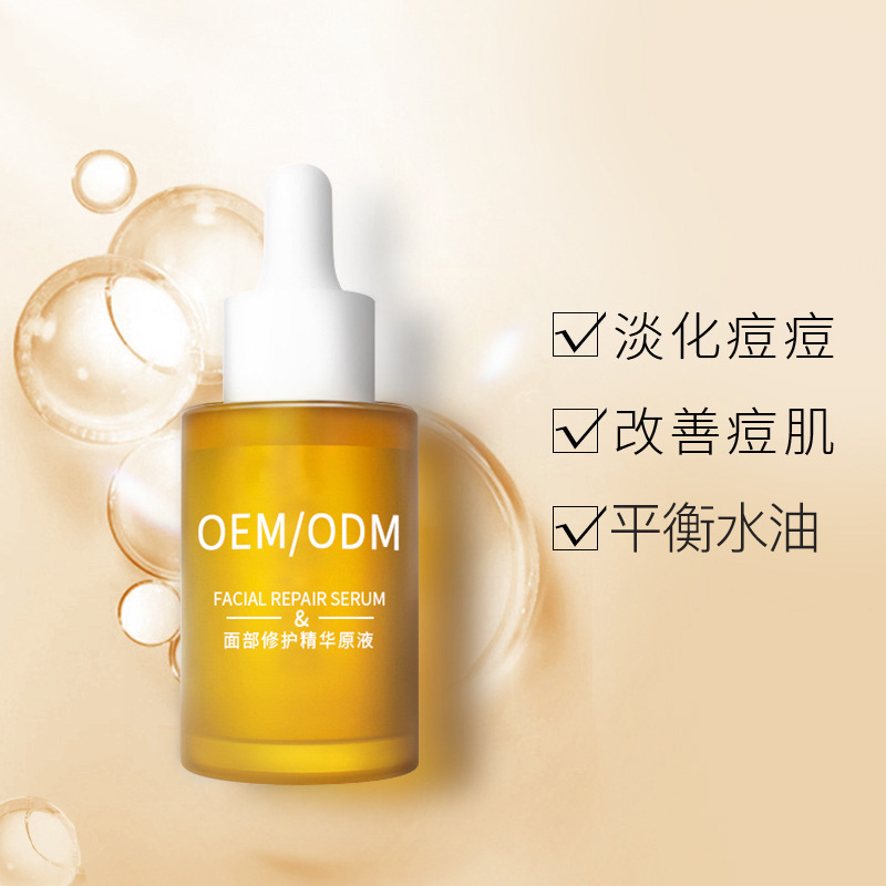 玉溪市_祛痘精华原液OEM